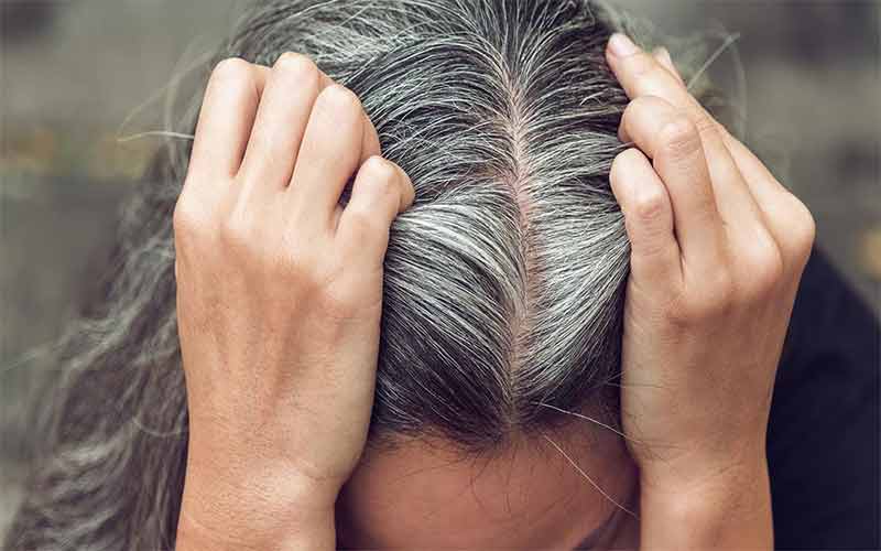 علت رنگ نگرفتن موی سفید